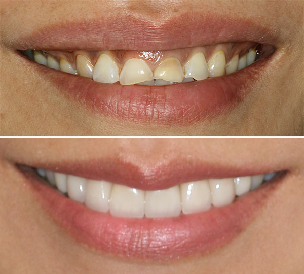 Mavis Before After