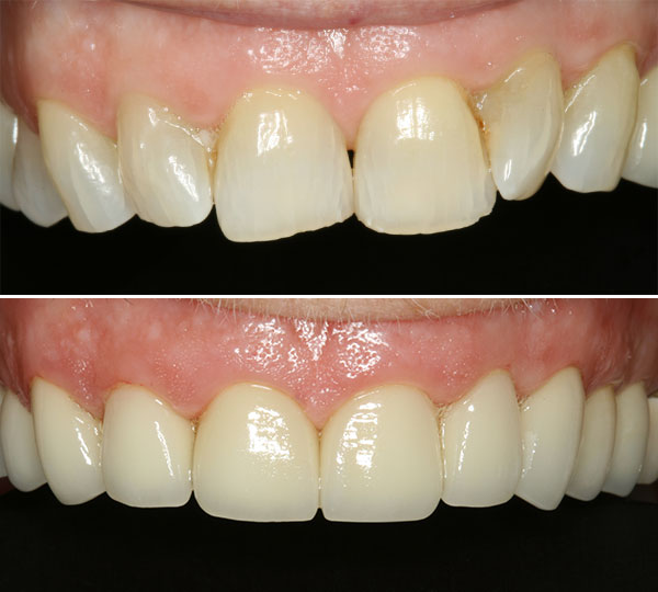 Lynn Before After